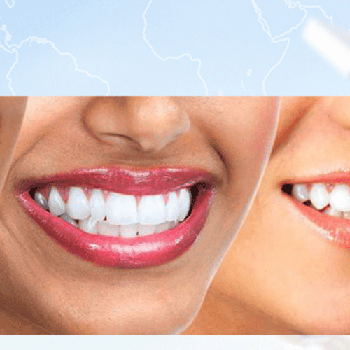 Tips to Find the Best Bone Graft Procedure in San Jose, Costa Rica